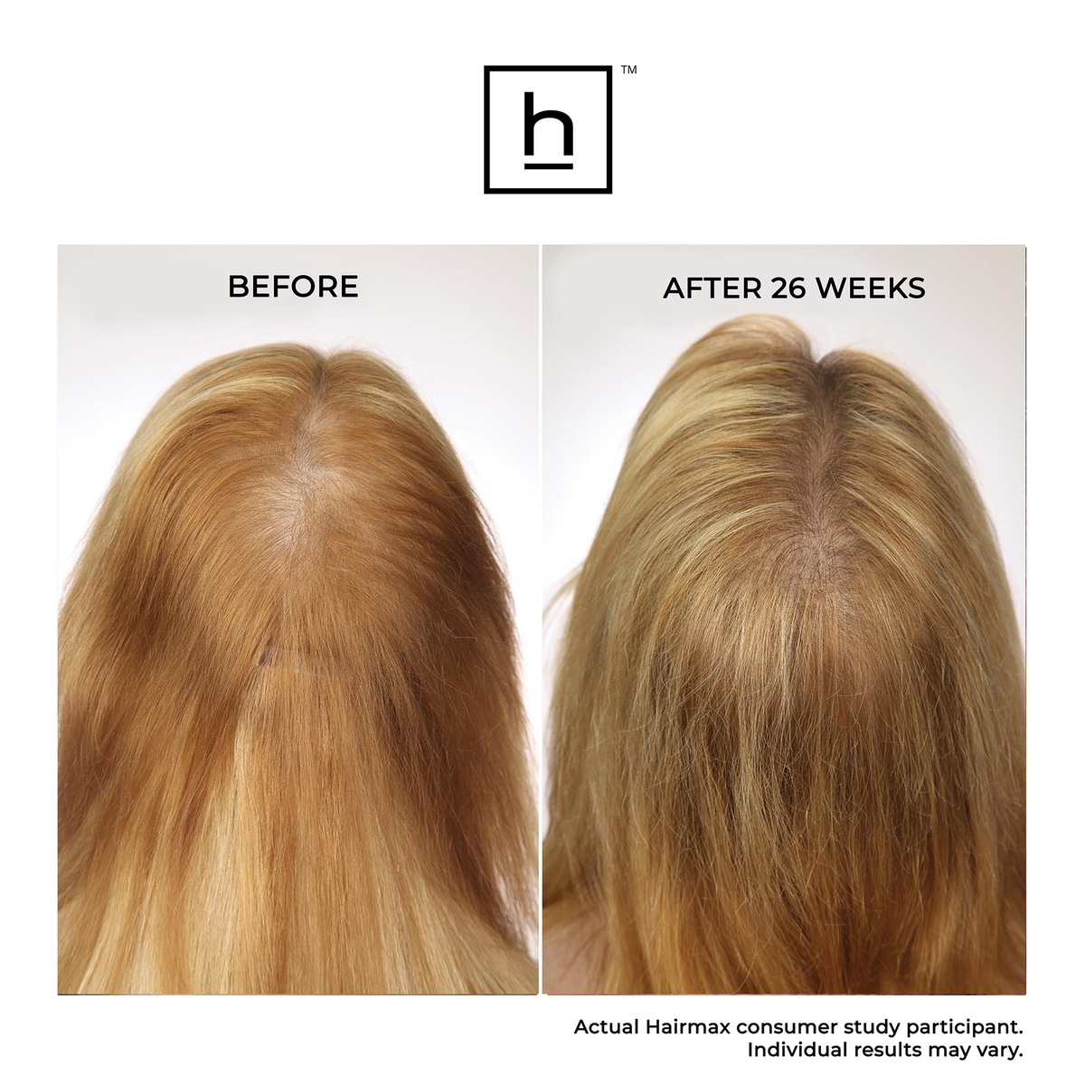 Bande laser 41 ComfortFlex