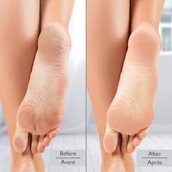 VacuPedi 6