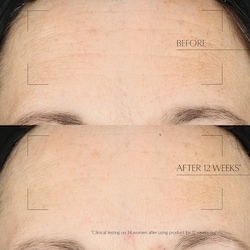 Advanced Night Repair Overnight Treatment 3
