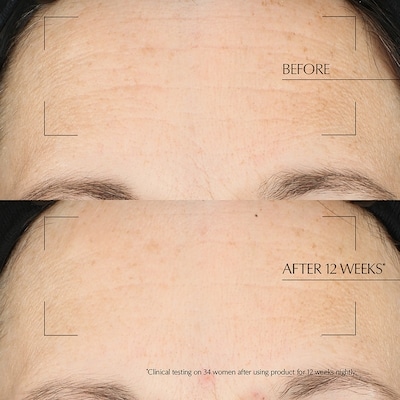 Advanced Night Repair Overnight Treatment 3