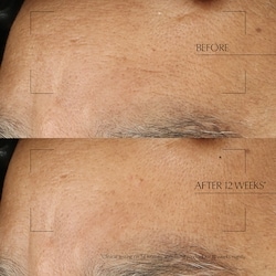 Advanced Night Repair Overnight Treatment 6