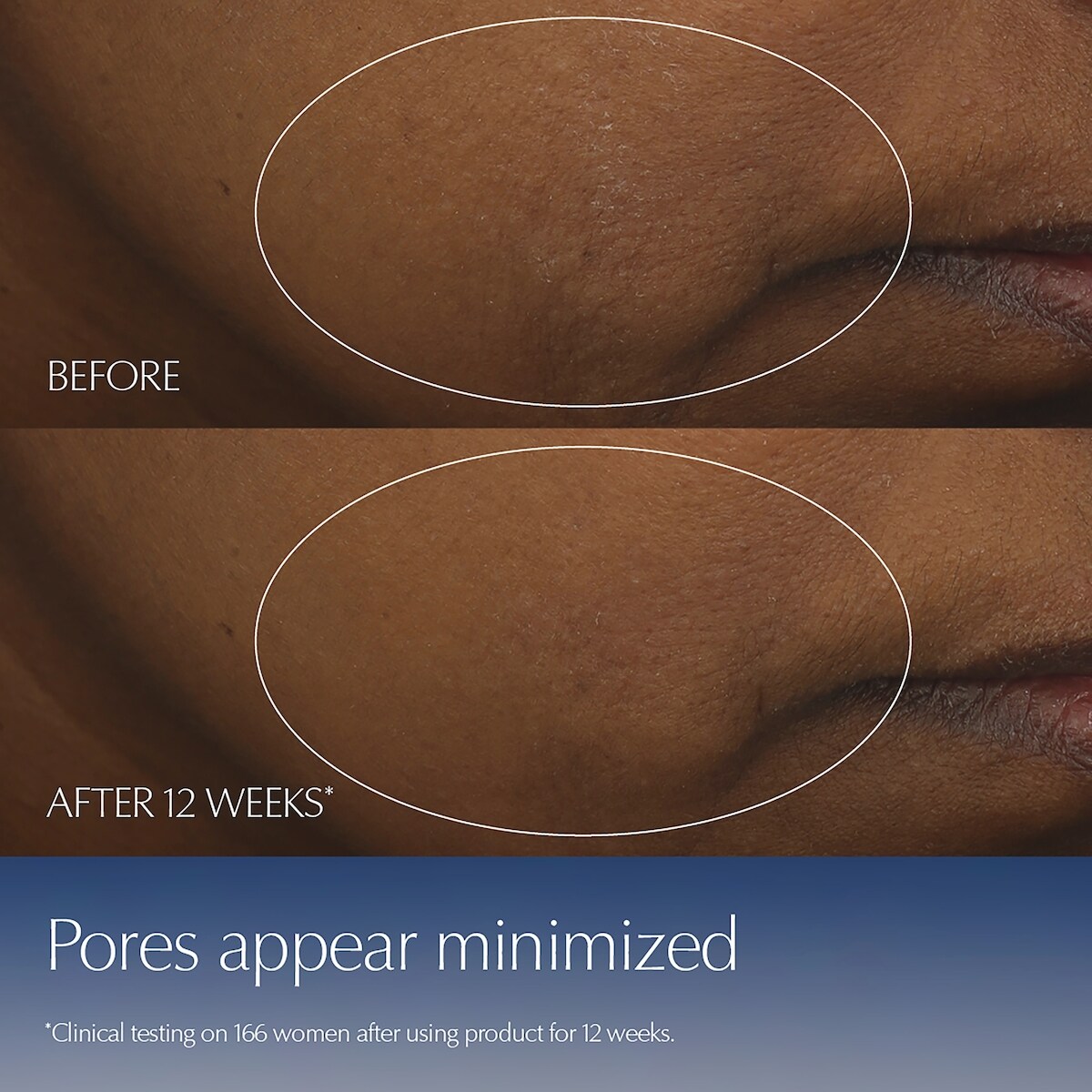 Advanced Night Repair Serum Limited Edition Bottle